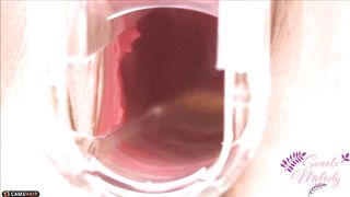 Sweetxmelody Shrew Fatty Masturbates Sex Toy